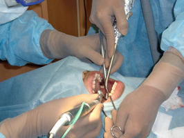 前歯部のインプラント植立術と下顎へのインプラント植立術の手術を行ってきました4